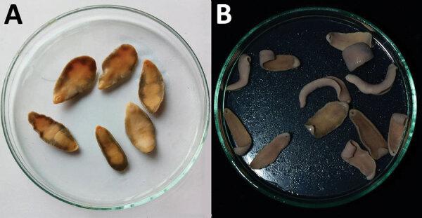https://cdn.ncbi.nlm.nih.gov/pmc/blobs/5aef/9155878/6b79f17079d6/22-0171-F1.jpg