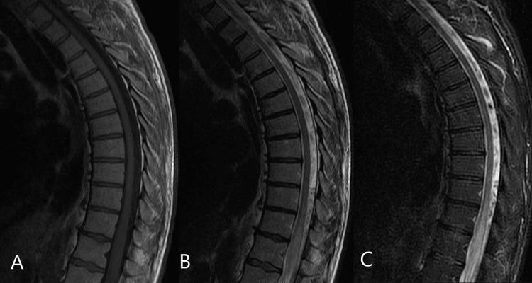 https://cdn.ncbi.nlm.nih.gov/pmc/blobs/5b02/10234455/c0e9bb832557/cureus-0015-00000038448-i01.jpg