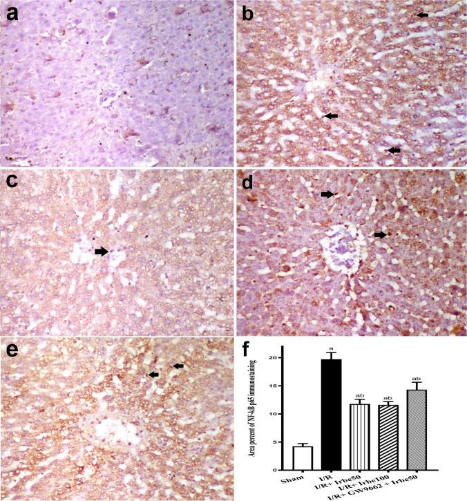 https://cdn.ncbi.nlm.nih.gov/pmc/blobs/5b08/11825560/5eb4a80b428e/210_2024_3301_Fig4_HTML.jpg