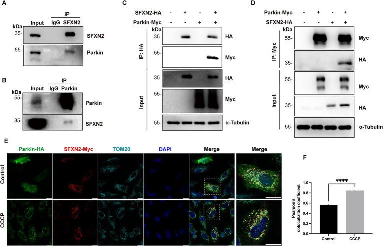 https://cdn.ncbi.nlm.nih.gov/pmc/blobs/5b12/12391048/5a4dae3d5c43/fncel-19-1623747-g003.jpg