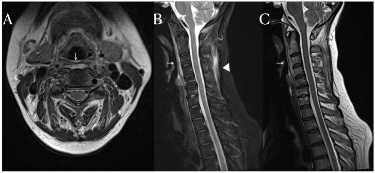 https://cdn.ncbi.nlm.nih.gov/pmc/blobs/5b36/10802139/71a97eb9f777/diagnostics-14-00010-g001.jpg