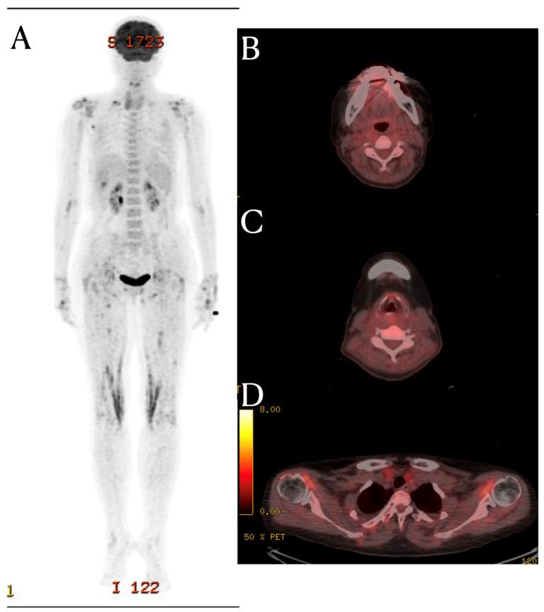 https://cdn.ncbi.nlm.nih.gov/pmc/blobs/5b36/10802139/7353ecd6a4b1/diagnostics-14-00010-g002.jpg
