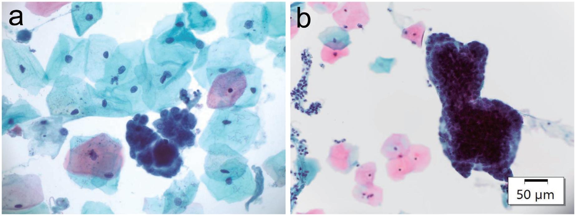 https://cdn.ncbi.nlm.nih.gov/pmc/blobs/5b3b/10348779/5d17f0308874/nihms-1895426-f0002.jpg