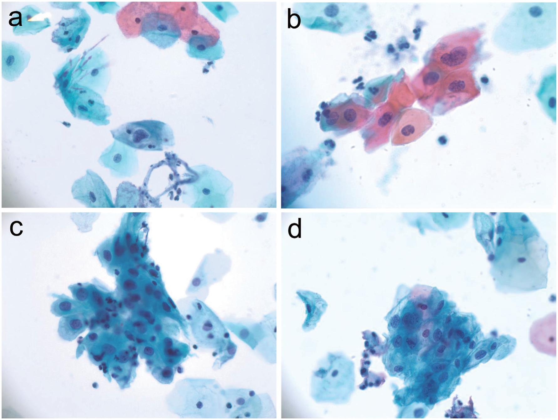 https://cdn.ncbi.nlm.nih.gov/pmc/blobs/5b3b/10348779/dde8b8a4d384/nihms-1895426-f0003.jpg