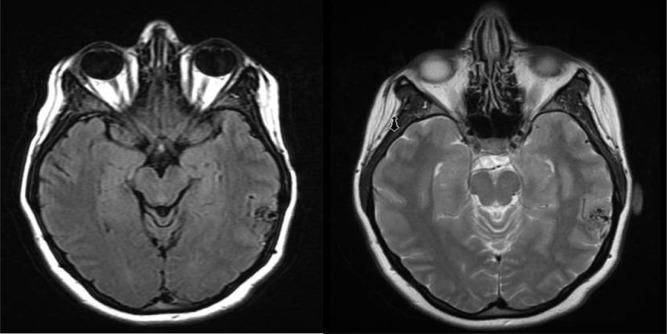 https://cdn.ncbi.nlm.nih.gov/pmc/blobs/5b41/4205255/1620742f8fca/jcen-16-275-g001.jpg