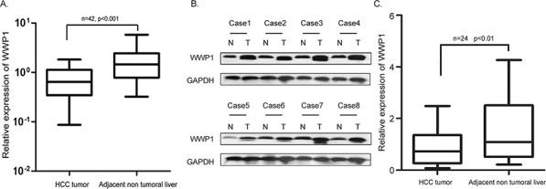 https://cdn.ncbi.nlm.nih.gov/pmc/blobs/5b45/4747378/e3a221b03451/oncotarget-06-40920-g001.jpg