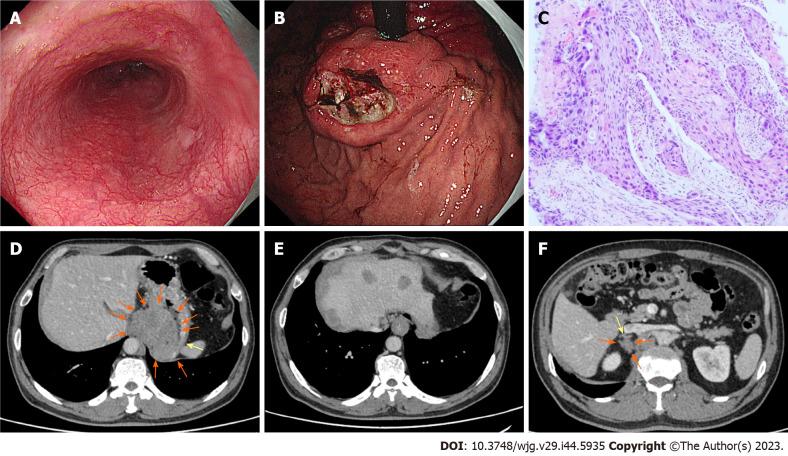https://cdn.ncbi.nlm.nih.gov/pmc/blobs/5b49/10725560/79b2a16808bb/WJG-29-5935-g005.jpg