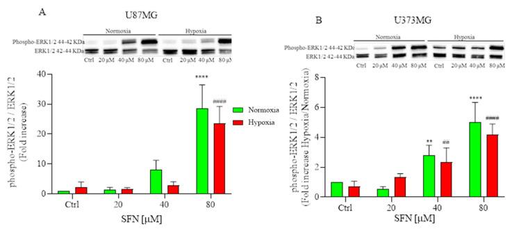 https://cdn.ncbi.nlm.nih.gov/pmc/blobs/5b49/8541491/053f0ef42856/ijms-22-11201-g005.jpg