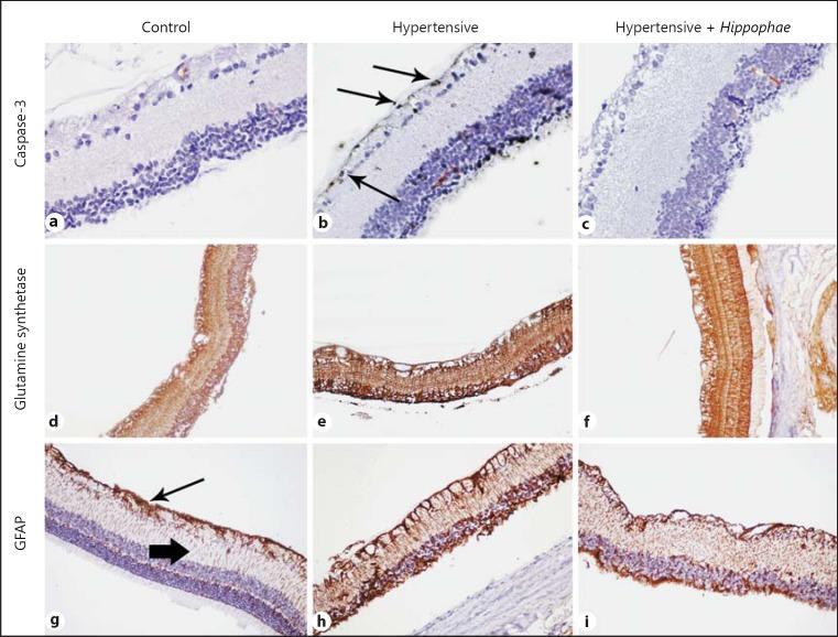 https://cdn.ncbi.nlm.nih.gov/pmc/blobs/5b52/6945930/cc85d78b5bc0/bmh-0002-0001-g07.jpg