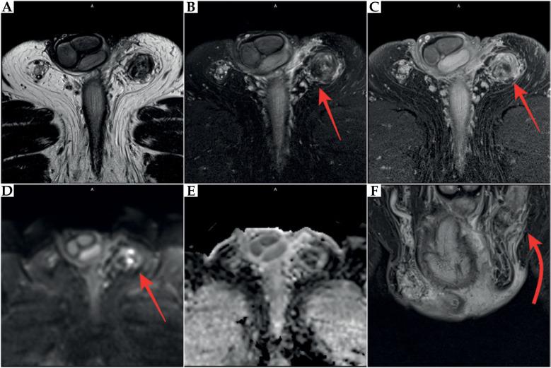 https://cdn.ncbi.nlm.nih.gov/pmc/blobs/5b58/12277955/da00460828e6/JCB-17-56383-g005.jpg