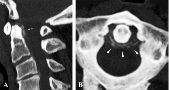 https://cdn.ncbi.nlm.nih.gov/pmc/blobs/5b58/5133471/42cda515df44/gr2.jpg