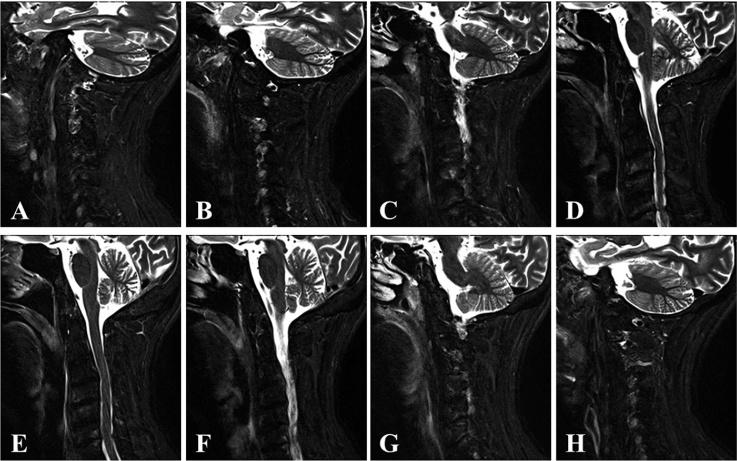 https://cdn.ncbi.nlm.nih.gov/pmc/blobs/5b58/5133471/a47d0daafa64/gr5.jpg