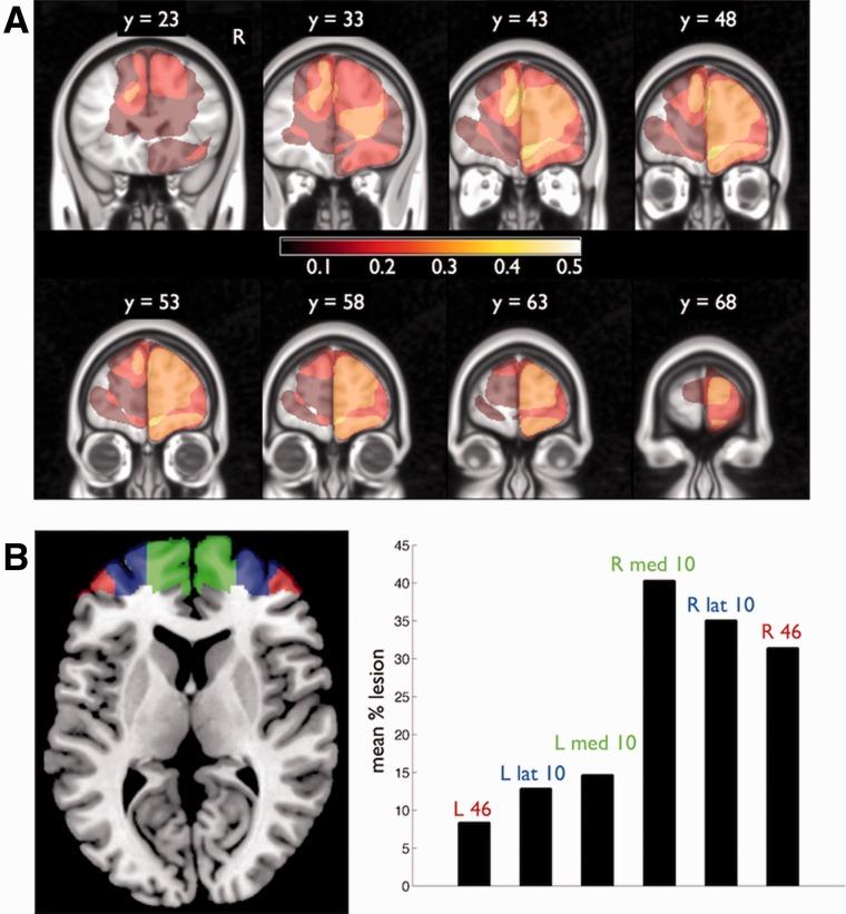 https://cdn.ncbi.nlm.nih.gov/pmc/blobs/5b5b/4163038/57452515fdb5/awu221f4p.jpg