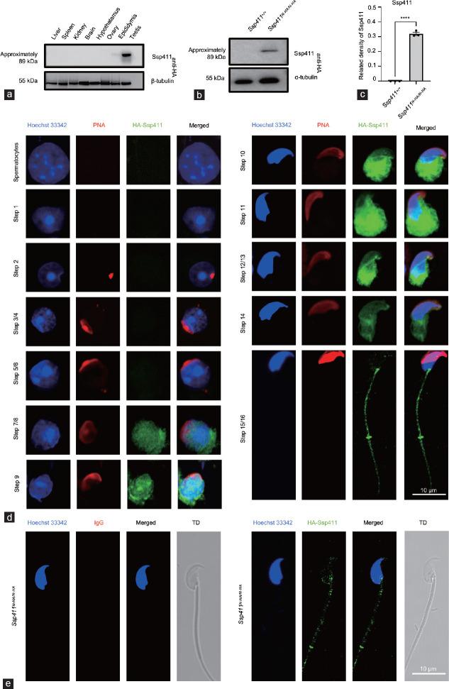 https://cdn.ncbi.nlm.nih.gov/pmc/blobs/5b5c/11784959/17457334f263/AJA-27-120-g003.jpg