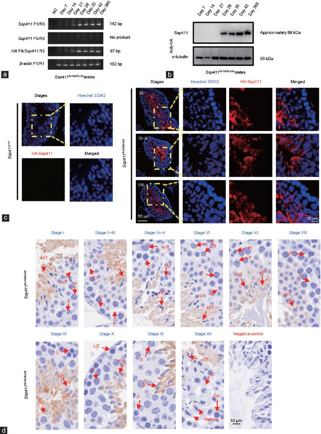https://cdn.ncbi.nlm.nih.gov/pmc/blobs/5b5c/11784959/5b041bb65ae9/AJA-27-120-g002.jpg