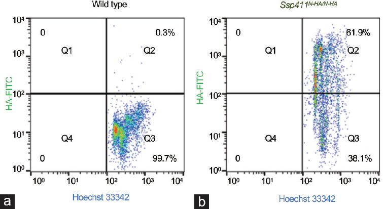 https://cdn.ncbi.nlm.nih.gov/pmc/blobs/5b5c/11784959/9c173520b2ad/AJA-27-120-g004.jpg