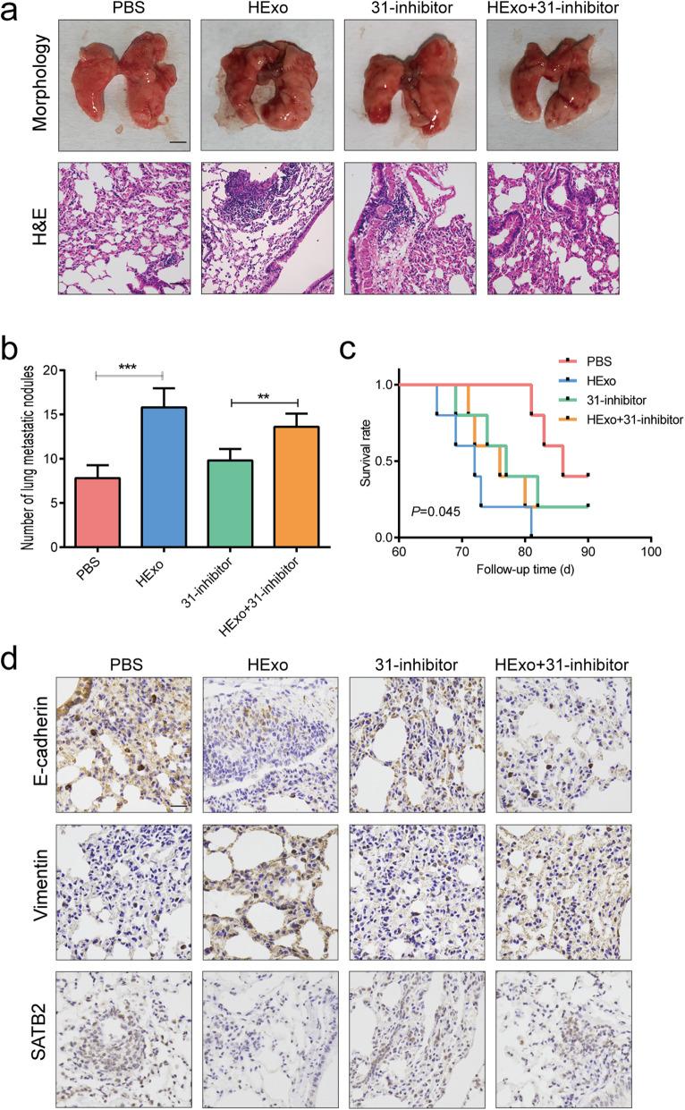 https://cdn.ncbi.nlm.nih.gov/pmc/blobs/5b63/8167983/0af14c773f7a/13046_2021_1979_Fig5_HTML.jpg