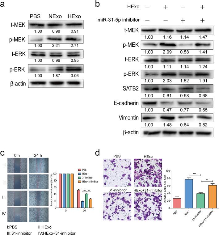 https://cdn.ncbi.nlm.nih.gov/pmc/blobs/5b63/8167983/2f2422b5416f/13046_2021_1979_Fig6_HTML.jpg
