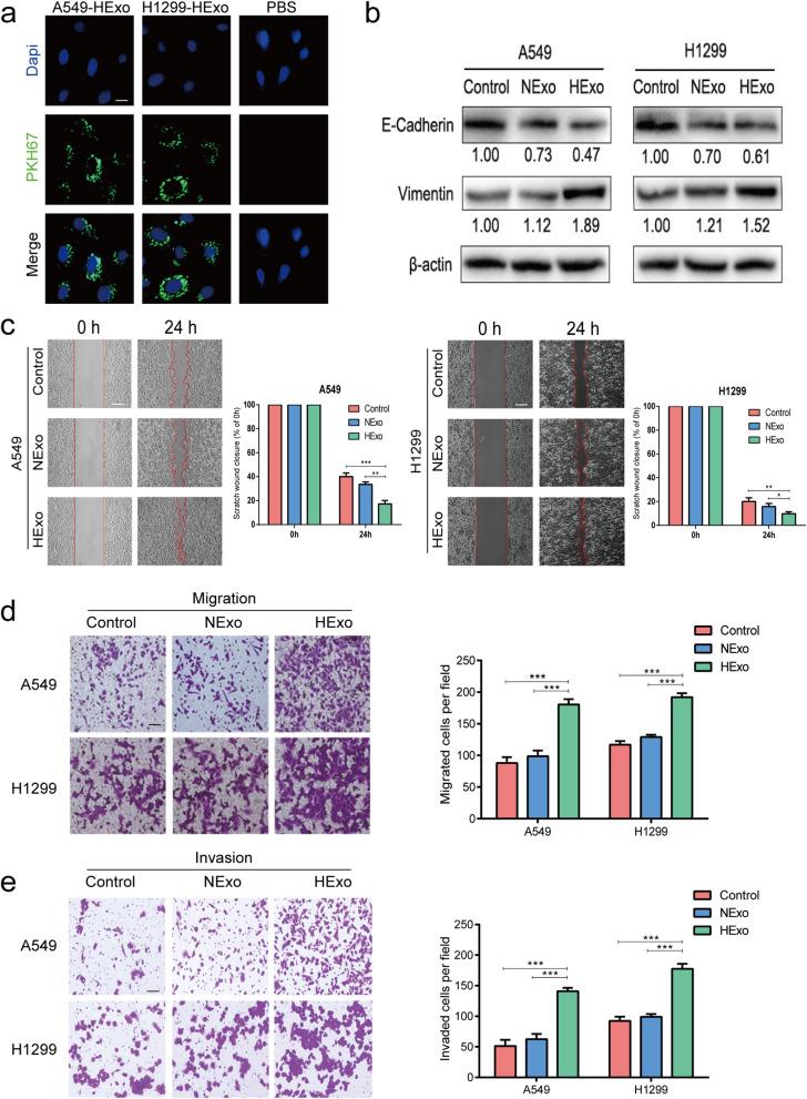 https://cdn.ncbi.nlm.nih.gov/pmc/blobs/5b63/8167983/dd580ee04e4e/13046_2021_1979_Fig2_HTML.jpg