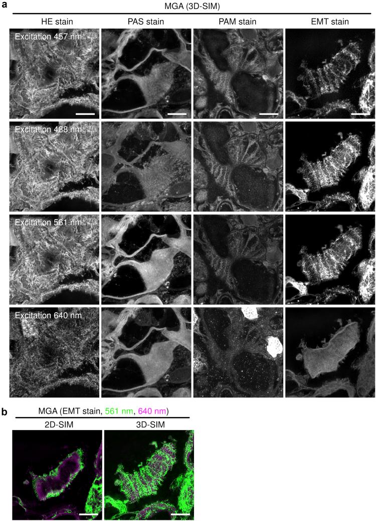 https://cdn.ncbi.nlm.nih.gov/pmc/blobs/5b67/8258503/d33de9d56b73/gr4.jpg