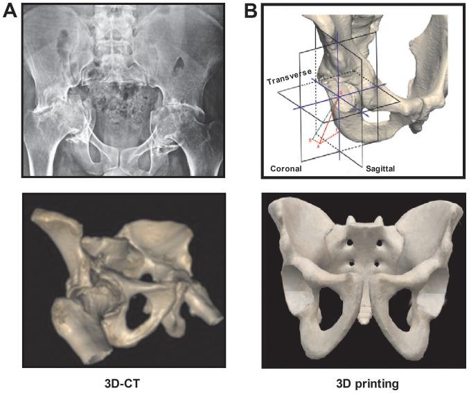 https://cdn.ncbi.nlm.nih.gov/pmc/blobs/5b74/6966232/1cedbcc03708/etm-19-02-1155-g00.jpg