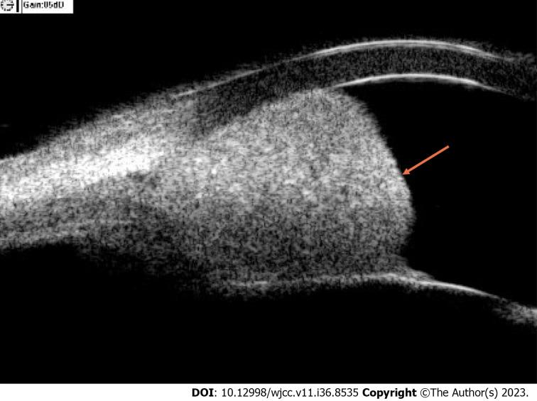 https://cdn.ncbi.nlm.nih.gov/pmc/blobs/5b77/10768508/60b852e542b1/WJCC-11-8535-g001.jpg