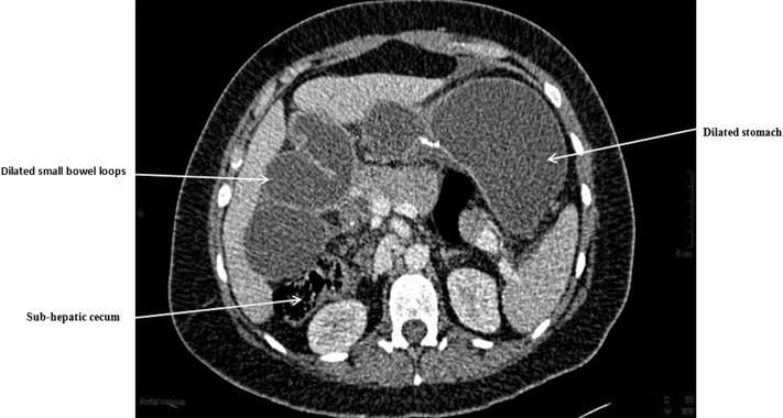 https://cdn.ncbi.nlm.nih.gov/pmc/blobs/5b7c/3771770/9cd1bdfd97c5/jls0031229110001.jpg