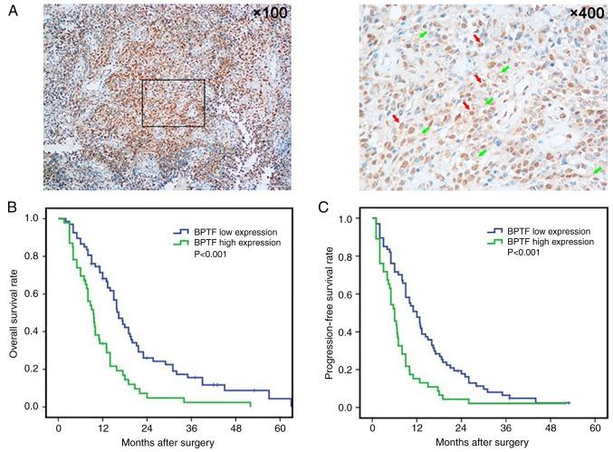 https://cdn.ncbi.nlm.nih.gov/pmc/blobs/5b7d/6278589/00c298b6557d/OR-41-01-0246-g02.jpg