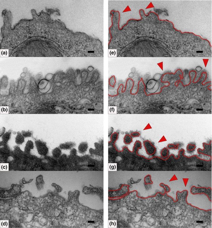 https://cdn.ncbi.nlm.nih.gov/pmc/blobs/5b87/11996704/363bd25db5ff/JOA-246-770-g007.jpg