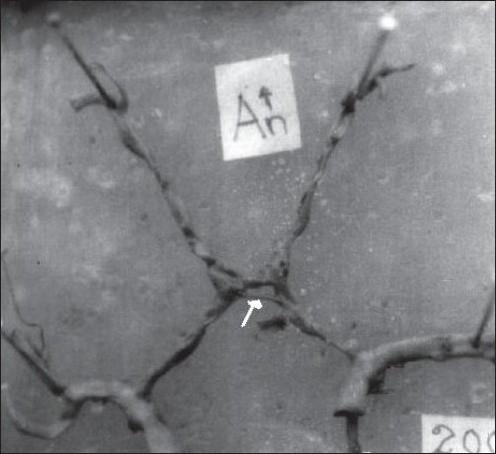 https://cdn.ncbi.nlm.nih.gov/pmc/blobs/5b89/2824931/fba0d2627efa/AIAN-12-157-g002.jpg