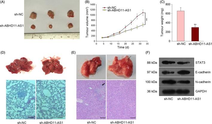 https://cdn.ncbi.nlm.nih.gov/pmc/blobs/5b94/6495520/71c095dd762e/CPR-52-e12569-g004.jpg