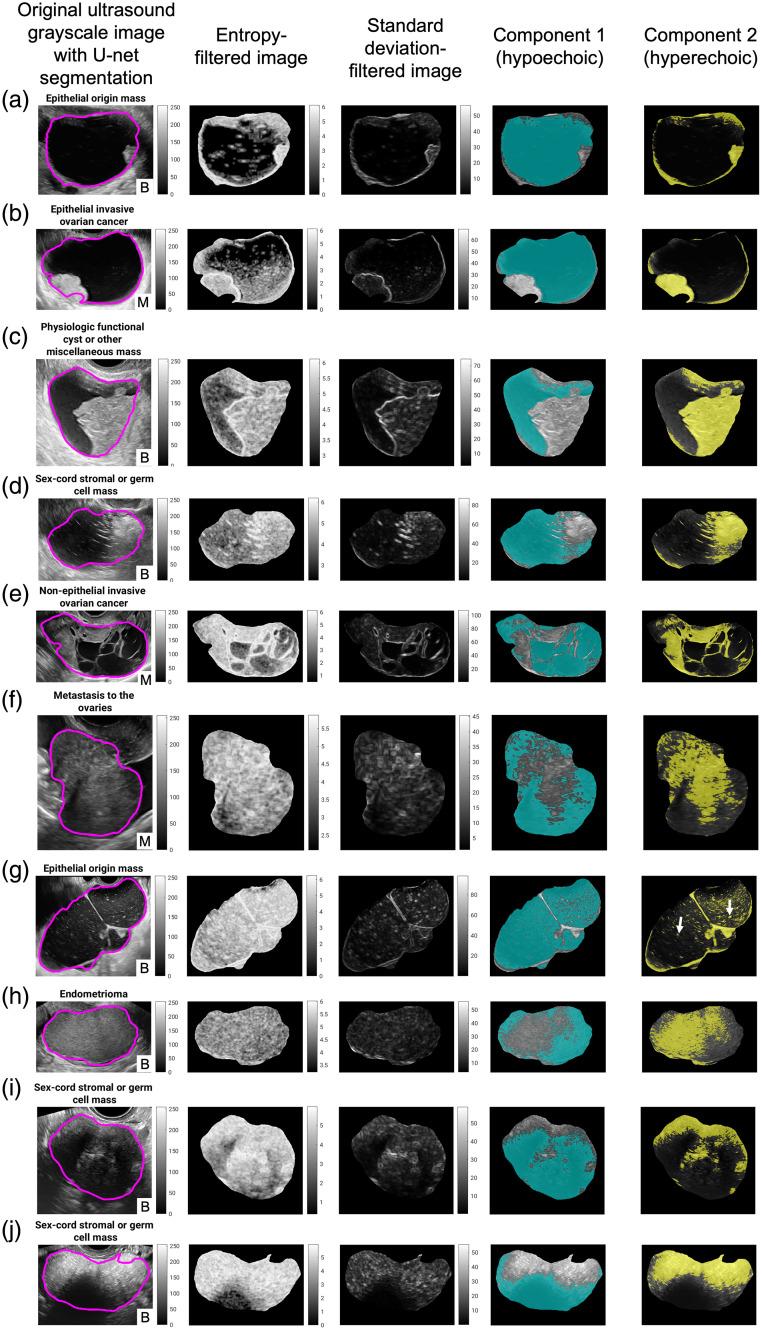 https://cdn.ncbi.nlm.nih.gov/pmc/blobs/5b95/11301525/527cb435236b/JMI-011-044505-g005.jpg