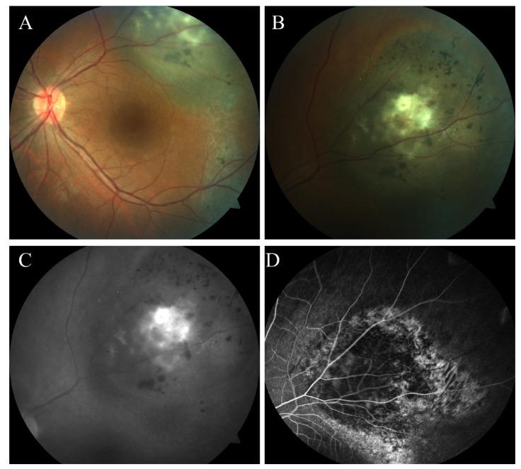 https://cdn.ncbi.nlm.nih.gov/pmc/blobs/5b96/9265106/1a02916f599f/cancers-14-03147-g006.jpg
