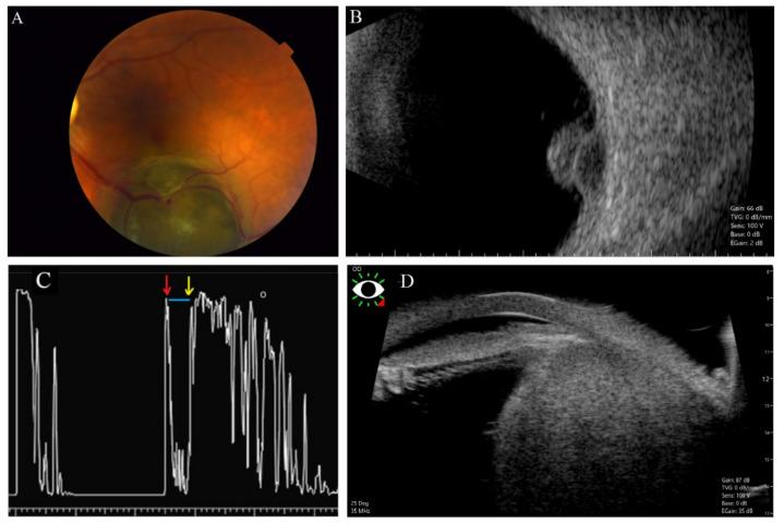 https://cdn.ncbi.nlm.nih.gov/pmc/blobs/5b96/9265106/5ad181d0c685/cancers-14-03147-g003.jpg