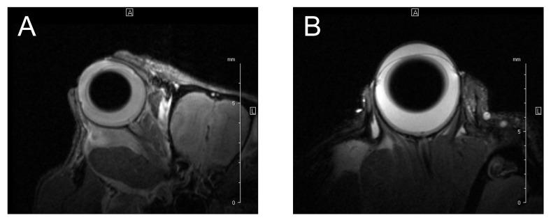 https://cdn.ncbi.nlm.nih.gov/pmc/blobs/5b96/9265106/6d0b654dabec/cancers-14-03147-g007.jpg