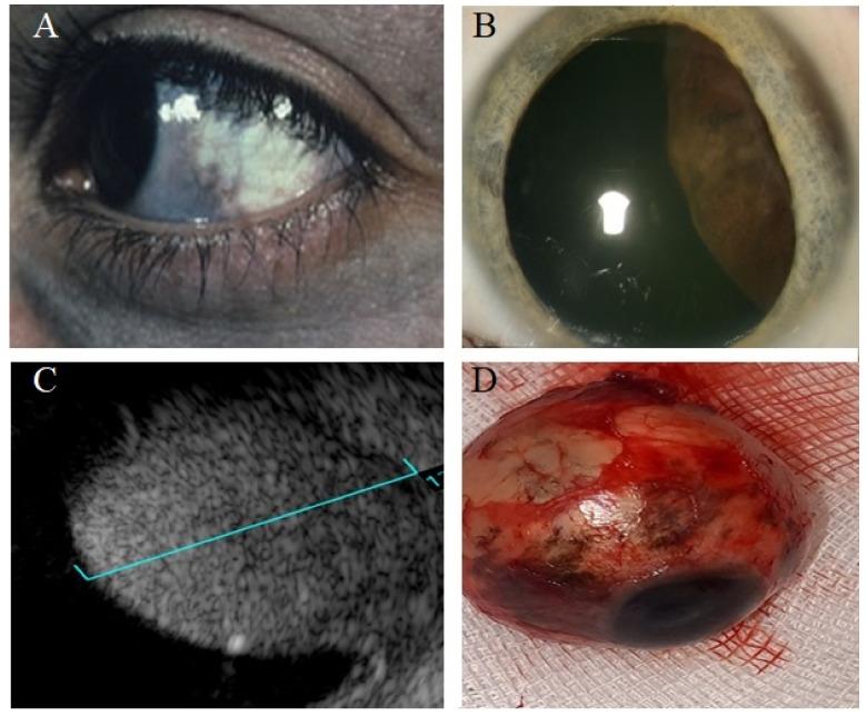 https://cdn.ncbi.nlm.nih.gov/pmc/blobs/5b96/9265106/e7d8af8d2d5c/cancers-14-03147-g005.jpg