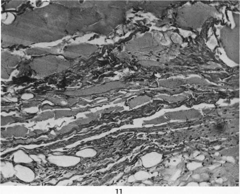 https://cdn.ncbi.nlm.nih.gov/pmc/blobs/5b98/1937429/0b632cbcce61/amjpathol00480-0026-a.jpg