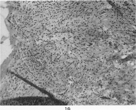 https://cdn.ncbi.nlm.nih.gov/pmc/blobs/5b98/1937429/2589951c0d97/amjpathol00480-0029-b.jpg