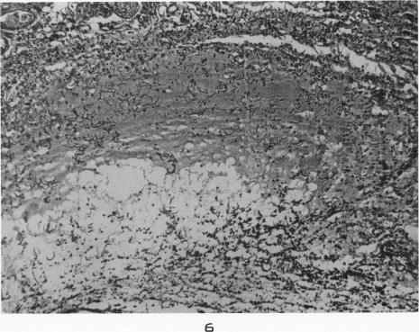 https://cdn.ncbi.nlm.nih.gov/pmc/blobs/5b98/1937429/2d275ee24a29/amjpathol00480-0023-a.jpg