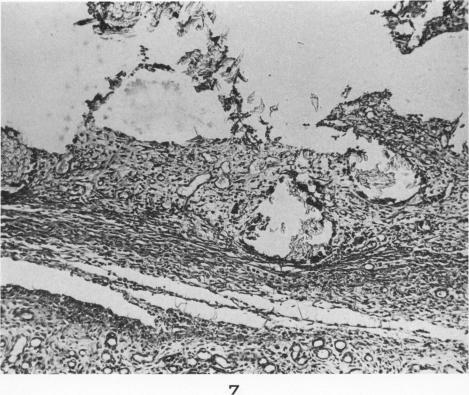 https://cdn.ncbi.nlm.nih.gov/pmc/blobs/5b98/1937429/55bedefe5c23/amjpathol00480-0023-b.jpg