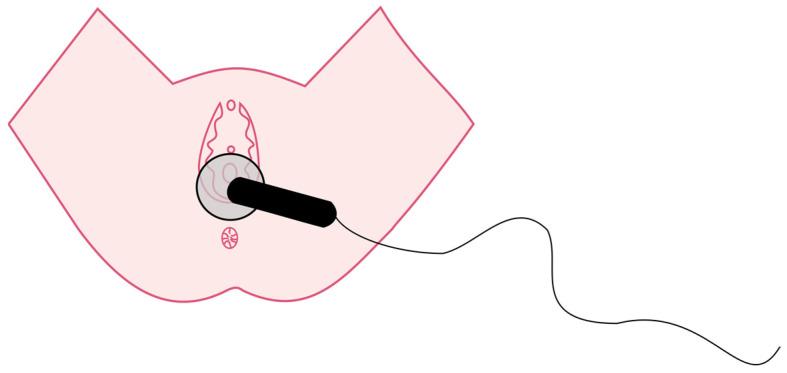 https://cdn.ncbi.nlm.nih.gov/pmc/blobs/5ba5/10532265/06f5d84a9992/jcm-12-06077-g003.jpg