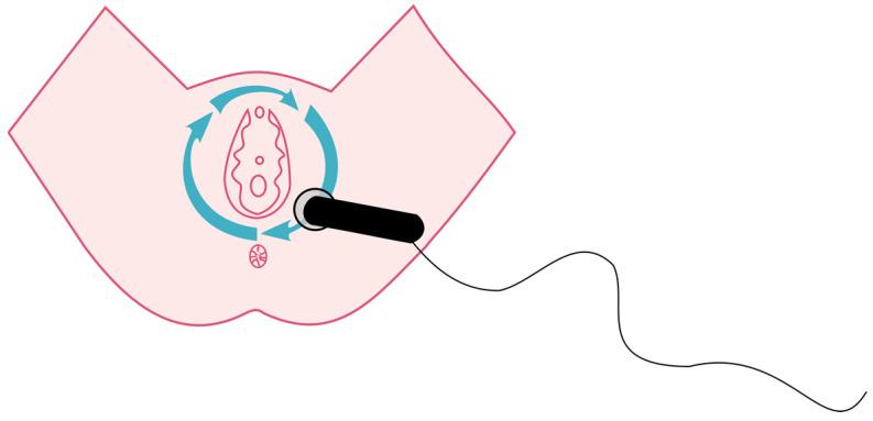 https://cdn.ncbi.nlm.nih.gov/pmc/blobs/5ba5/10532265/ce8c936fd854/jcm-12-06077-g002.jpg