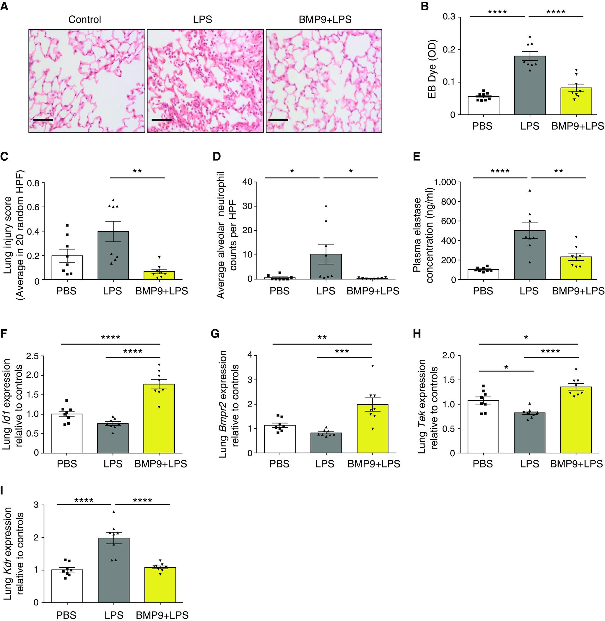 https://cdn.ncbi.nlm.nih.gov/pmc/blobs/5bac/8456542/1492b6b986ed/rccm.202005-1761OCf3.jpg