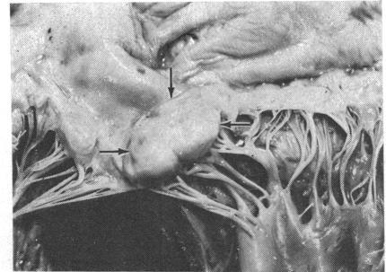 https://cdn.ncbi.nlm.nih.gov/pmc/blobs/5bb3/483431/be8828f01a8c/brheartj00219-0008-a.jpg