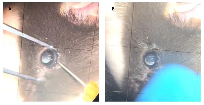 https://cdn.ncbi.nlm.nih.gov/pmc/blobs/5bb6/9409835/ce49efba0410/jcm-11-04717-g004.jpg