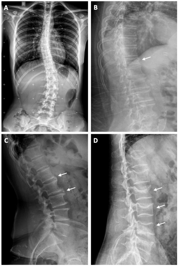 https://cdn.ncbi.nlm.nih.gov/pmc/blobs/5bbc/8395922/eb9dc94f0f9c/jfb-12-00043-g003.jpg