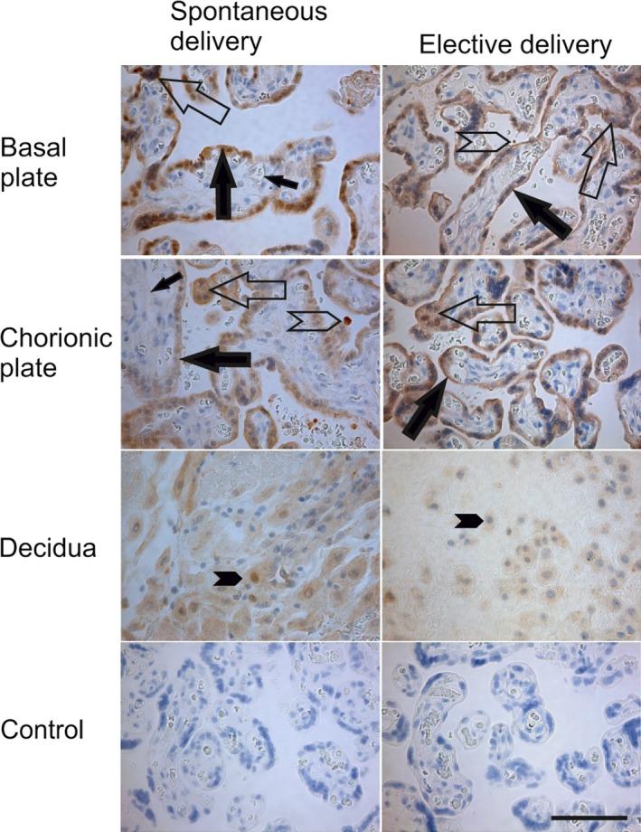 https://cdn.ncbi.nlm.nih.gov/pmc/blobs/5bbd/5783879/7e13564c548b/JCMM-22-968-g003.jpg