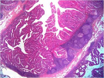 https://cdn.ncbi.nlm.nih.gov/pmc/blobs/5bc2/4495708/742fe72f39be/13000_2015_305_Fig3_HTML.jpg