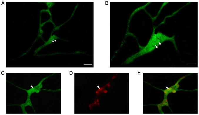 https://cdn.ncbi.nlm.nih.gov/pmc/blobs/5bc2/9798462/04f65dabee8e/etm-25-01-11766-g01.jpg