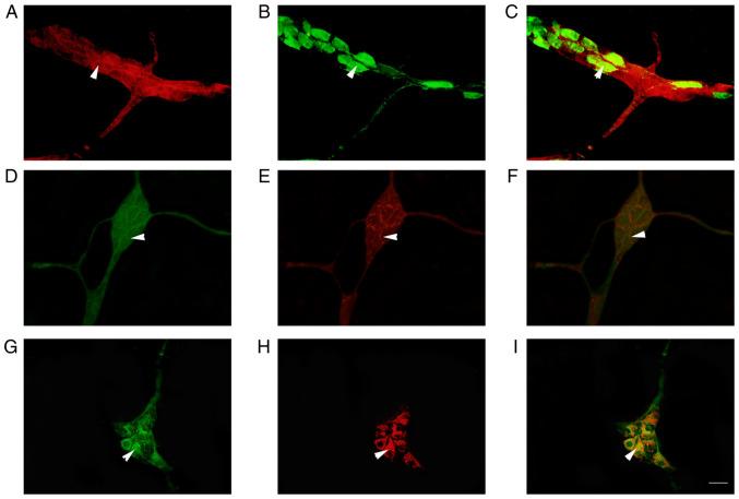 https://cdn.ncbi.nlm.nih.gov/pmc/blobs/5bc2/9798462/314d4a41e8b4/etm-25-01-11766-g03.jpg